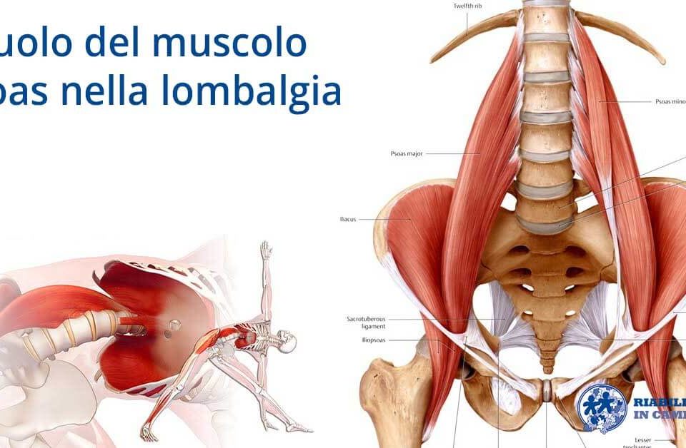 Il ruolo del muscolo Psoas nella lombalgia riabilitazione campania