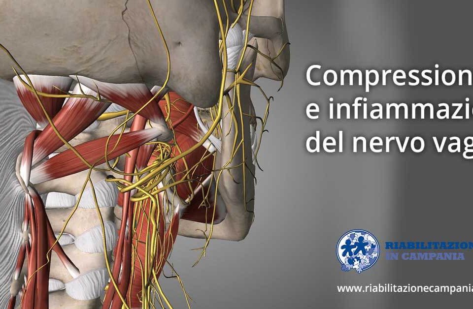 compressione e infiammazione del nervo vago napoli riabilitazione campania